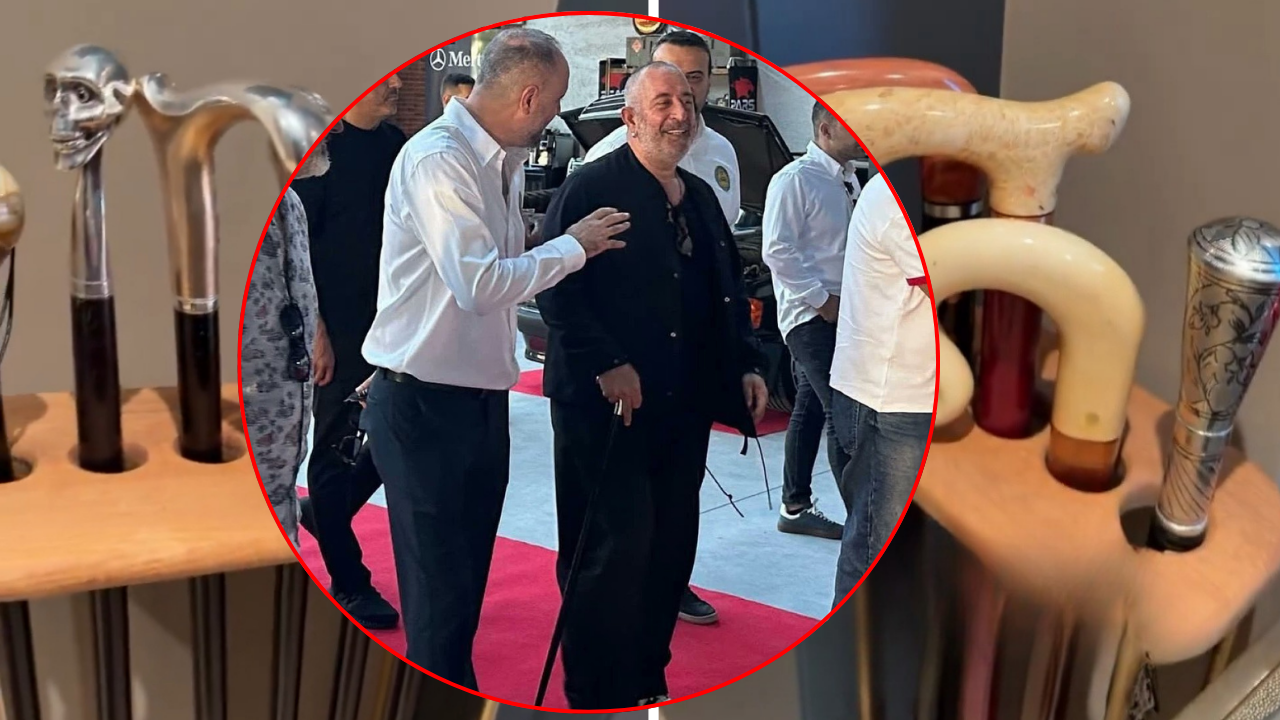 Bastonlu hali çok konuşuldu! Cem Yılmaz