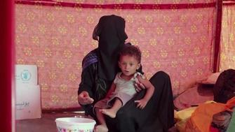 UNICEFTEN Yemen için kritik uyarı